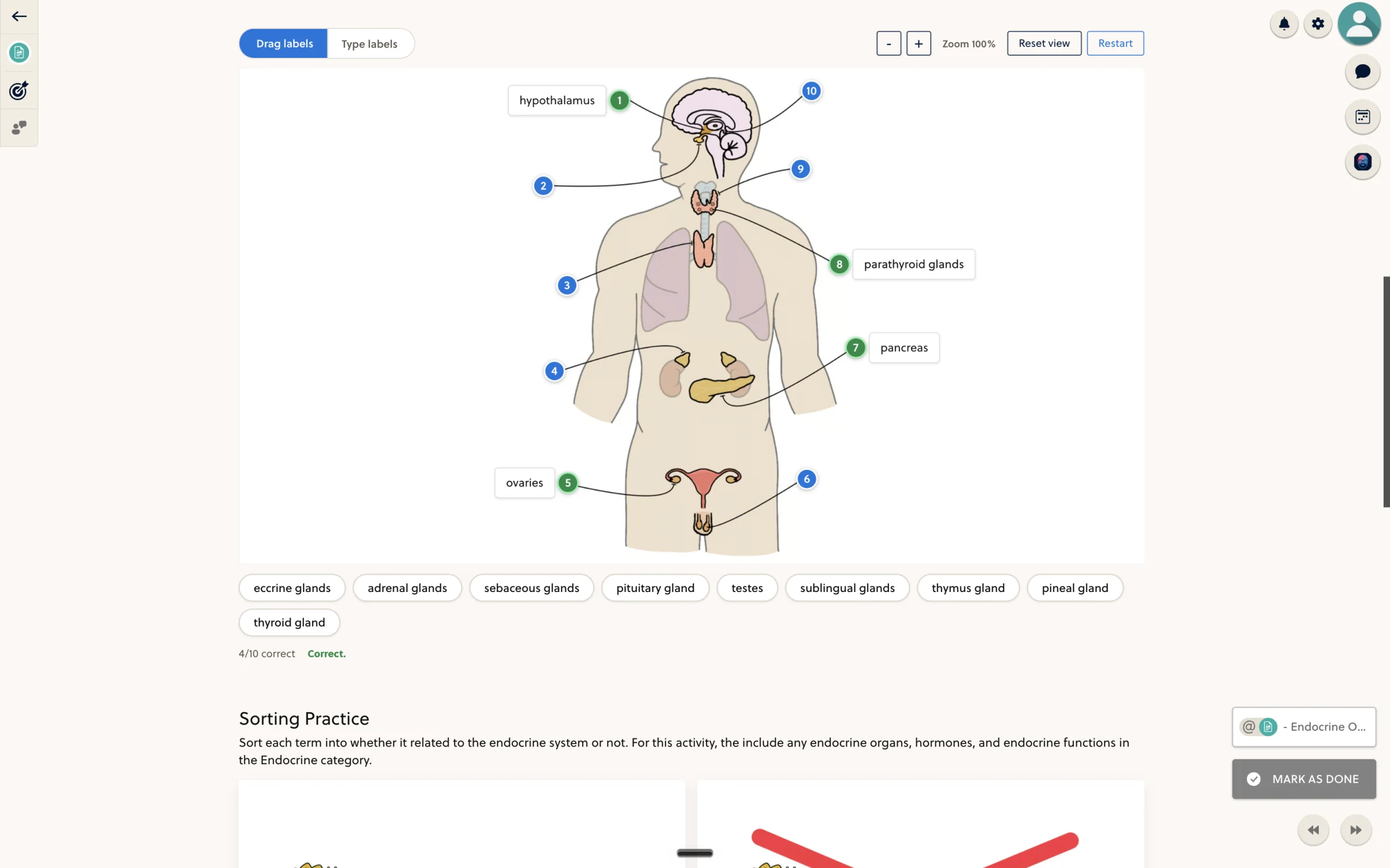 An actual Siebert Science lesson with an endocrine-system diagram, draggable labels and immediate answer feedback